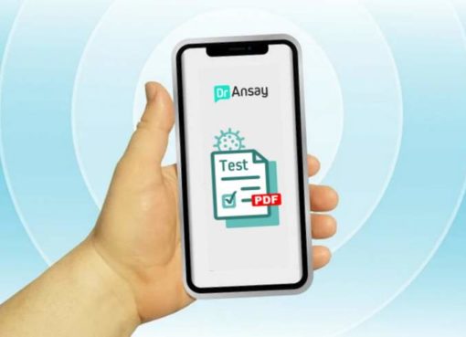 Covid-19-Antigen Schnelltests